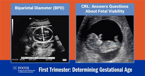 dating ultrasound first trimester